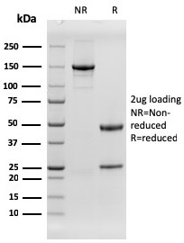 EGFR Recombinant Monoclonal Mouse Antibody (rGFR/1667)