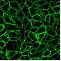 Endoglin / CD105 Monoclonal Mouse Antibody (ENG/1621)