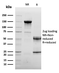 Endoglin / CD105 Monoclonal Mouse Antibody (ENG/3269)