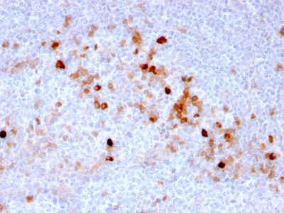 Endoglin / CD105 Monoclonal Mouse Antibody (ENG/3269)
