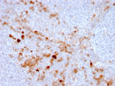 Endoglin / CD105 Monoclonal Mouse Antibody (ENG/3269)