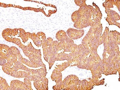 Ep-CAM / CD326 Monoclonal Mouse Antibody (323/A3)