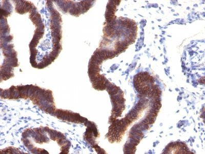 Ep-CAM / CD326 Monoclonal Mouse Antibody (EGP40/1120)