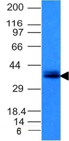 Ep-CAM / CD326 Monoclonal Mouse Antibody (EGP40/1120)