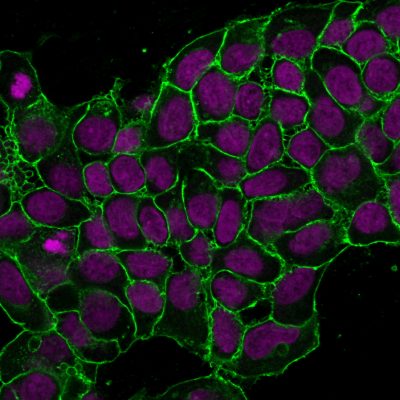 Ep-CAM / CD326 Monoclonal Mouse Antibody (EGP40/1372)