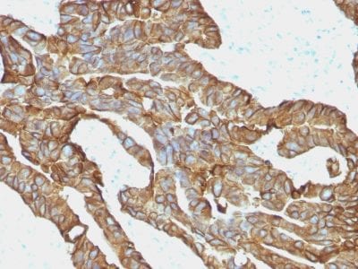 Ep-CAM / CD326 Monoclonal Mouse Antibody (EGP40/1372)