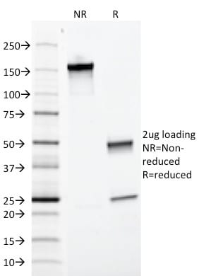 Ep-CAM / CD326 Monoclonal Mouse Antibody (EGP40/1372)