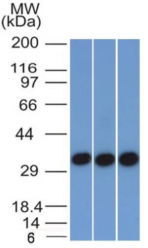 Ep-CAM / CD326 Monoclonal Mouse Antibody (EGP40/1372)
