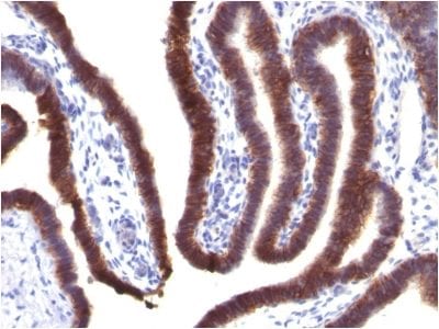 Ep-CAM / CD326 Monoclonal Mouse Antibody (EGP40/1373)