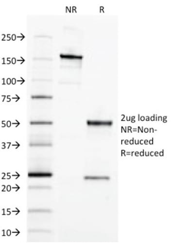 Ep-CAM / CD326 Monoclonal Mouse Antibody (EGP40/1373)