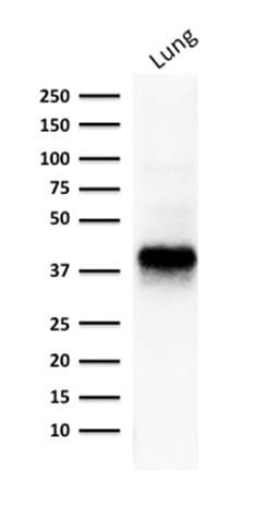 Ep-CAM / CD326 Monoclonal Mouse Antibody (EGP40/1373)