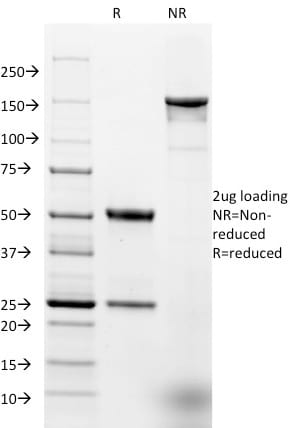 Ep-CAM / CD326 Monoclonal Mouse Antibody (EGP40/1384)