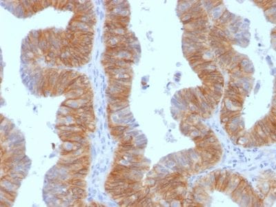 Ep-CAM / CD326 Monoclonal Mouse Antibody (EGP40/1384)