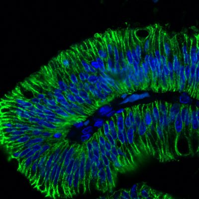 Ep-CAM / CD326 Monoclonal Mouse Antibody (EGP40/1798)