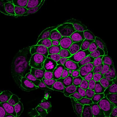 Ep-CAM / CD326 Monoclonal Mouse Antibody (EGP40/1798)