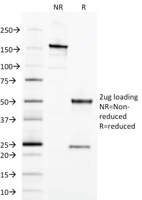 Ep-CAM / CD326 Monoclonal Mouse Antibody (EGP40/1798)