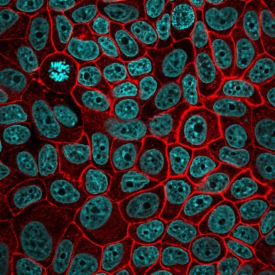 Ep-CAM / CD326 Monoclonal Mouse Antibody (EGP40/826)