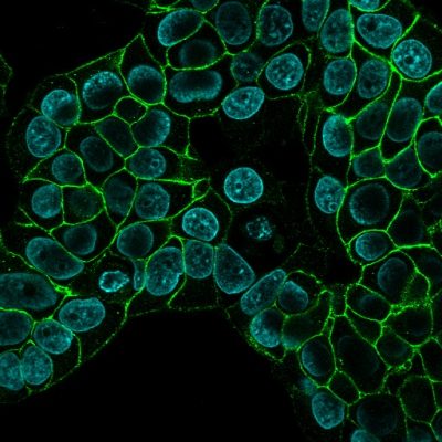 Ep-CAM / CD326 Monoclonal Mouse Antibody (EGP40/826)