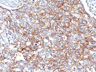 Ep-CAM / CD326 Monoclonal Mouse Antibody (EGP40/826)