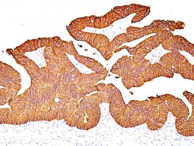 Ep-CAM / CD326 Monoclonal Mouse Antibody (EGP40/837)