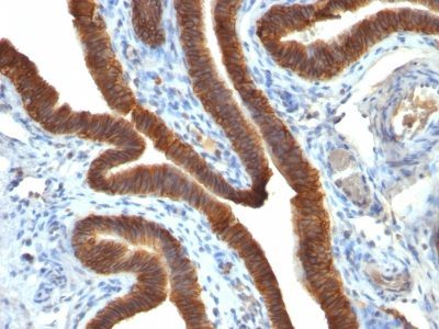 Ep-CAM / CD326 Monoclonal Mouse Antibody (EGP40/837)