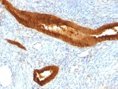 Ep-CAM / CD326 Monoclonal Mouse Antibody (EGP40/837)