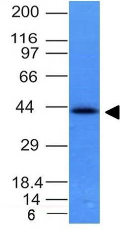 Ep-CAM / CD326 Monoclonal Mouse Antibody (EGP40/837)