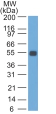 Ep-CAM / CD326 Monoclonal Mouse Antibody (GZ-1)