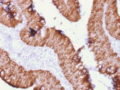 Ep-CAM / CD326 Recombinant Monoclonal Mouse Antibody (rEGP40/1372)
