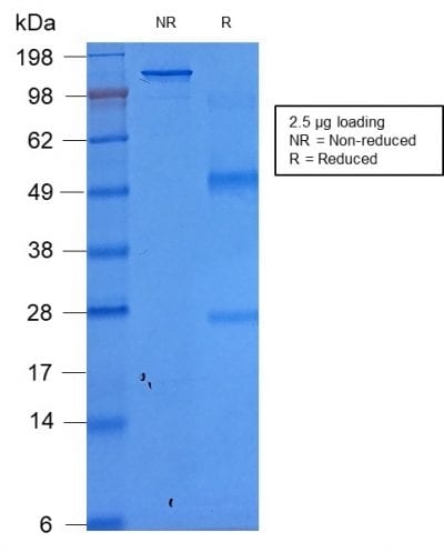 Ep-CAM / CD326 Recombinant Monoclonal Mouse Antibody (rEGP40/1372)