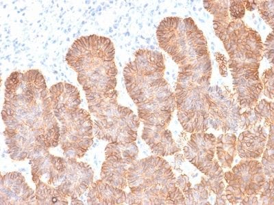 Ep-CAM / CD326 Recombinant Monoclonal Mouse Antibody (rEGP40/1372)