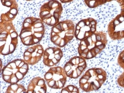 Ep-CAM / CD326 Recombinant Monoclonal Mouse Antibody (rMOC-31)