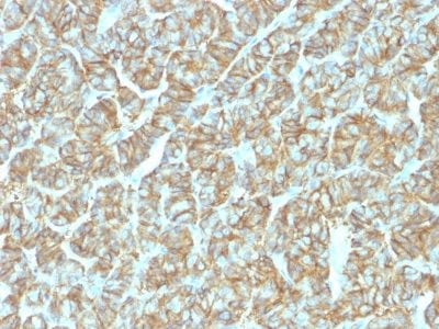Ep-CAM / CD326 Recombinant Monoclonal Rabbit Antibody (EGP40/1555R)