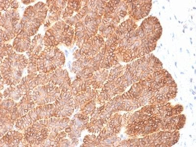 Ep-CAM / CD326 Recombinant Monoclonal Rabbit Antibody (EGP40/2041R)
