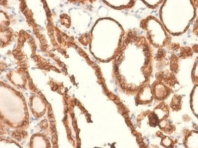 Ep-CAM / CD326 Recombinant Monoclonal Rabbit Antibody (EGP40/2041R)