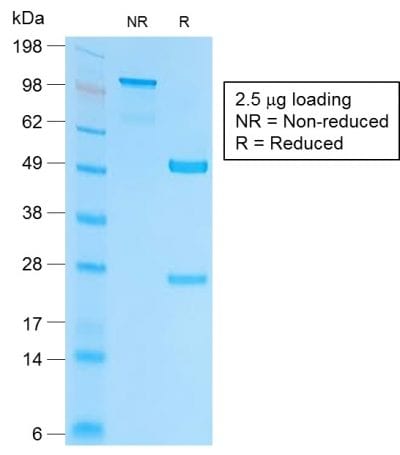 Ep-CAM / CD326 Recombinant Monoclonal Rabbit Antibody (EGP40/2041R)