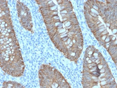 Ep-CAM / CD326 Recombinant Monoclonal Rabbit Antibody (EGP40/2571R)