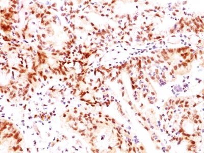 Estrogen Receptor Beta 1 Monoclonal Mouse Antibody (ERb455)