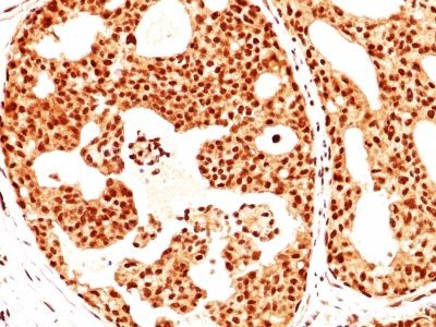 Estrogen Receptor Beta 1 Monoclonal Mouse Antibody (ERb455)