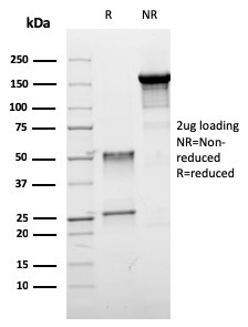 Estrogen Receptor Beta 1 Monoclonal Mouse Antibody (ESR2/3005)