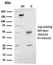 Estrogen Receptor Beta 1 Monoclonal Mouse Antibody (ESR2/3207)