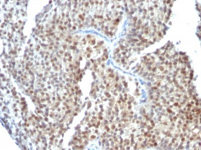 Estrogen Receptor Beta 1 Monoclonal Mouse Antibody (ESR2/686)