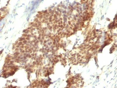 Estrogen Receptor Beta 1 Monoclonal Mouse Antibody (ESR2/686)