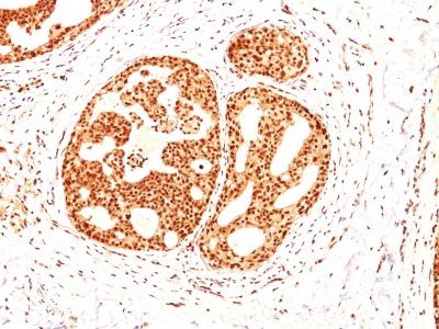 Estrogen Receptor Beta 1 Monoclonal Mouse Antibody (ESR2/686)