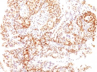 Estrogen Receptor Beta 1 Monoclonal Mouse Antibody (ESR2/686)