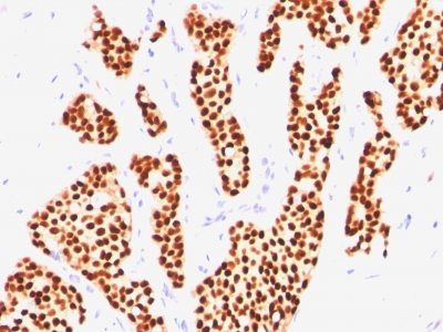 Estrogen Receptor Monoclonal Mouse Antibody (ER505)