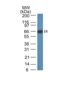 Estrogen Receptor Monoclonal Mouse Antibody (ER505)