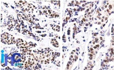Estrogen Receptor Monoclonal Mouse Antibody (ER506)