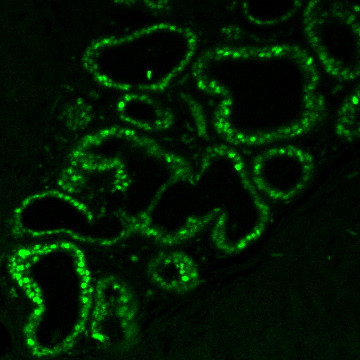 Estrogen Receptor Monoclonal Mouse Antibody (ER506)