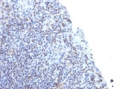 ETS1 Monoclonal Mouse Antibody (ETS1/1282)
